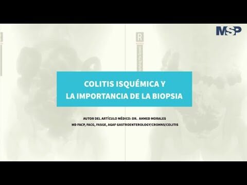Diagn&oacute;stico y tratamiento de la colitis ulcerosa: abordaje de problemas digestivos