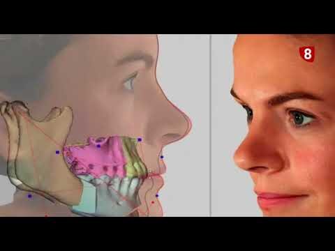 Ortodoncia: La soluci&oacute;n para problemas dentales