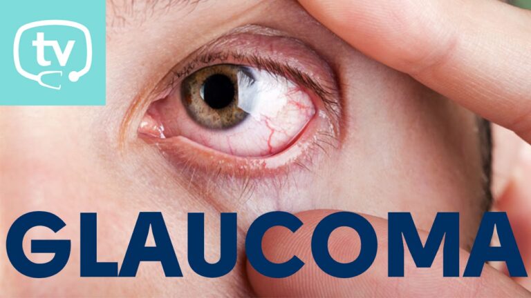 El impacto del glaucoma silencioso en la salud ocular.
