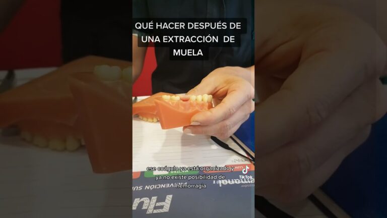 La importancia de la extracci&oacute;n de muelas en la salud bucal