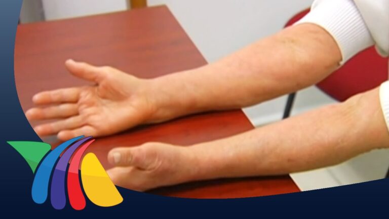 Impacto Emocional de la Dermatitis Al&eacute;rgica por Alergias