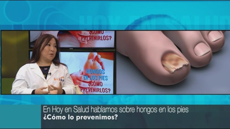 Prevenci&oacute;n del Pie de Atleta: Claves para una Higiene Adecuada