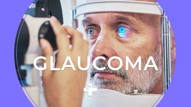Riesgos del glaucoma silencioso para la salud ocular