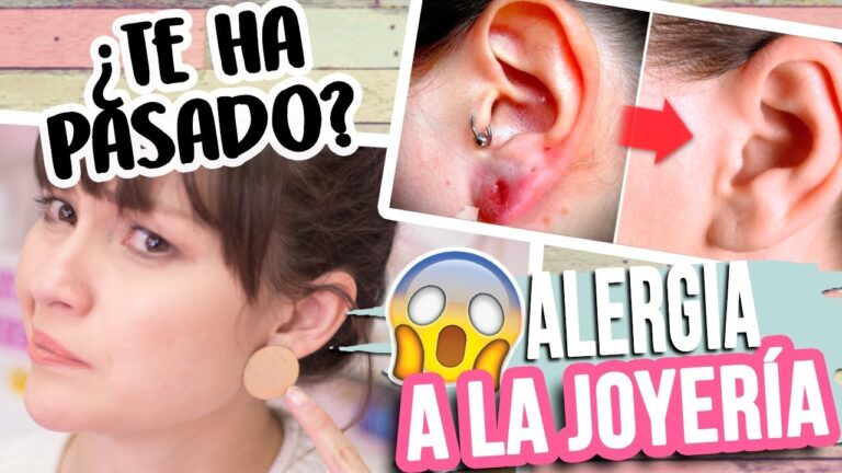 Evoluci&oacute;n de la Alergia a Metales a lo Largo del Tiempo