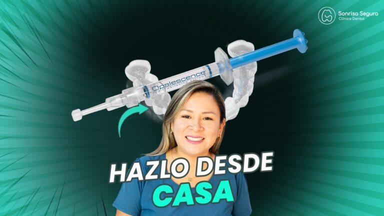 Descubre los secretos del fluoruro para una sonrisa brillante