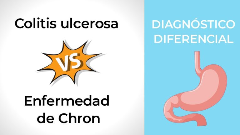 Prevenci&oacute;n de Complicaciones Digestivas en la Colitis Ulcerosa