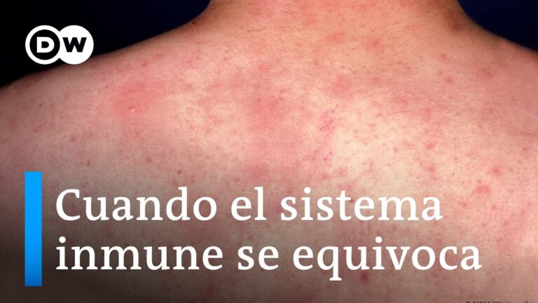 Educaci&oacute;n Esencial sobre Dermatitis Al&eacute;rgica y Alergias
