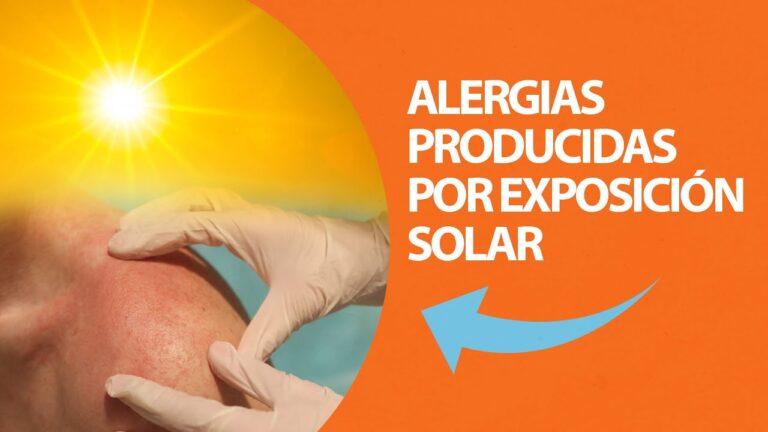 Gu&iacute;a de Protecci&oacute;n Solar para Personas con Alergia al Sol