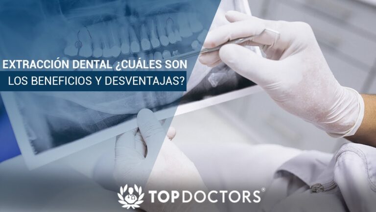 Beneficios de la Extracci&oacute;n Dental para la Salud Bucal