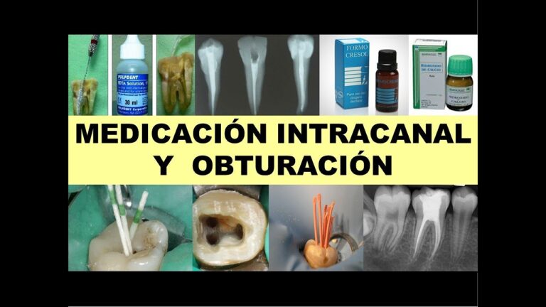 Impacto de la Infecci&oacute;n Pulpar en la Higiene Dental