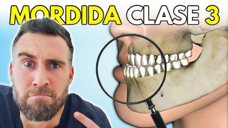 Correcci&oacute;n Efectiva de la Maloclusi&oacute;n en Ni&ntilde;os