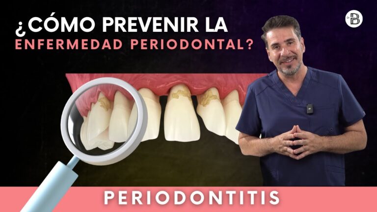 Cuidado Bucal Efectivo para Prevenir Enfermedad Periodontal