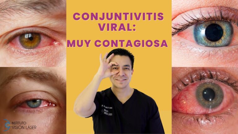 Prevenci&oacute;n y Contagio de la Conjuntivitis Viral