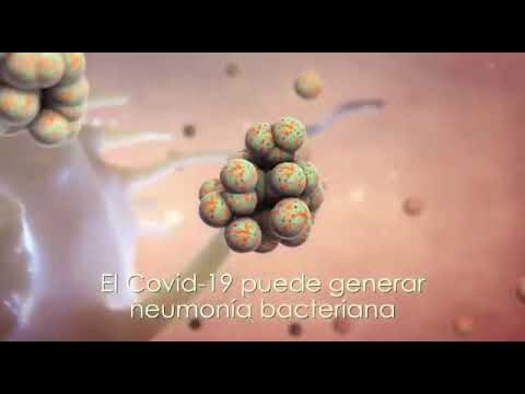 Neumon&iacute;a Bacteriana: Comprendiendo su Impacto en Enfermedades Comunes