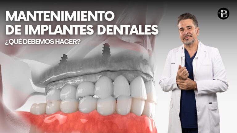 Consejos Clave para Cuidar la Salud Dental con Implantes
