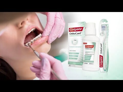 La importancia del cuidado dental con brackets