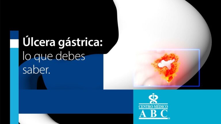 Complicaciones de &Uacute;lcera G&aacute;strica en Enfermedades Comunes