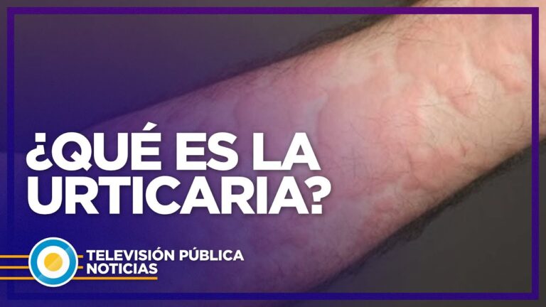 Alergia al Calor: Su V&iacute;nculo con la Urticaria