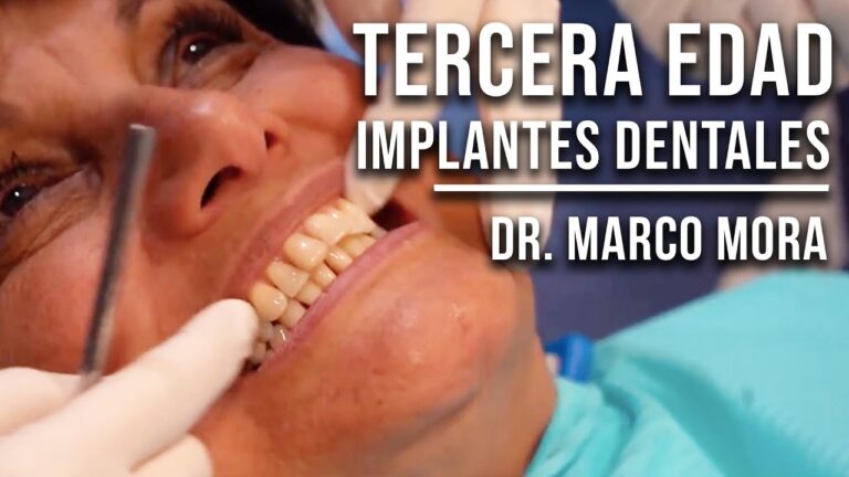Opciones de Tratamientos Odontol&oacute;gicos para Adultos Mayores