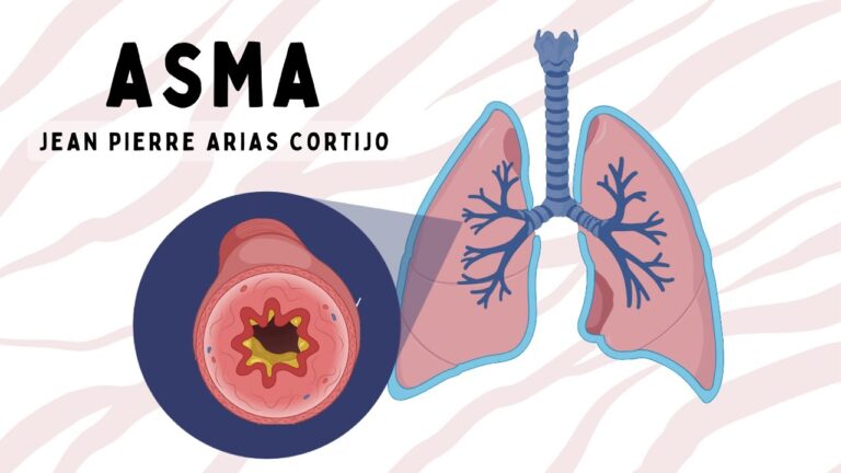 Manejo Efectivo del Asma Bronquial
