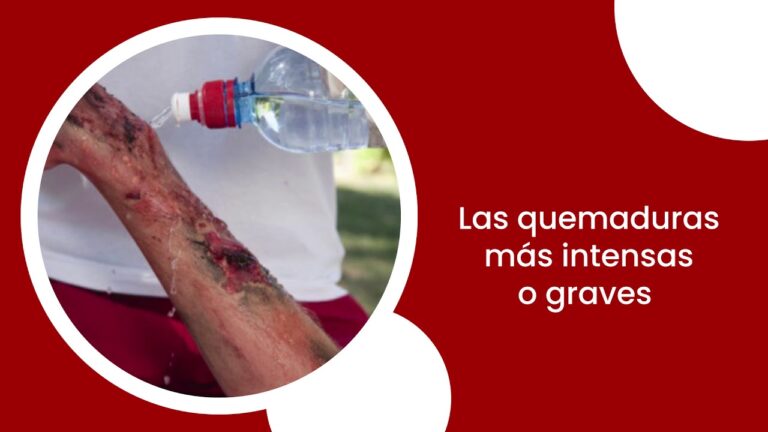 Atenci&oacute;n Inmediata en Caso de Electrocuci&oacute;n Dom&eacute;stica