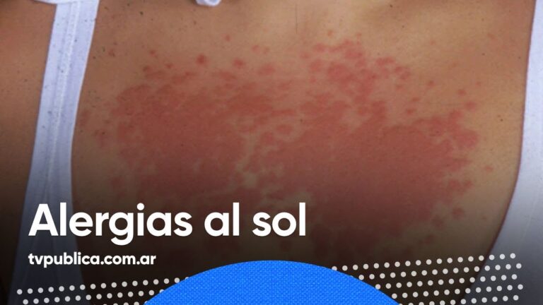 Consejos Efectivos para Prevenir Alergias al Calor